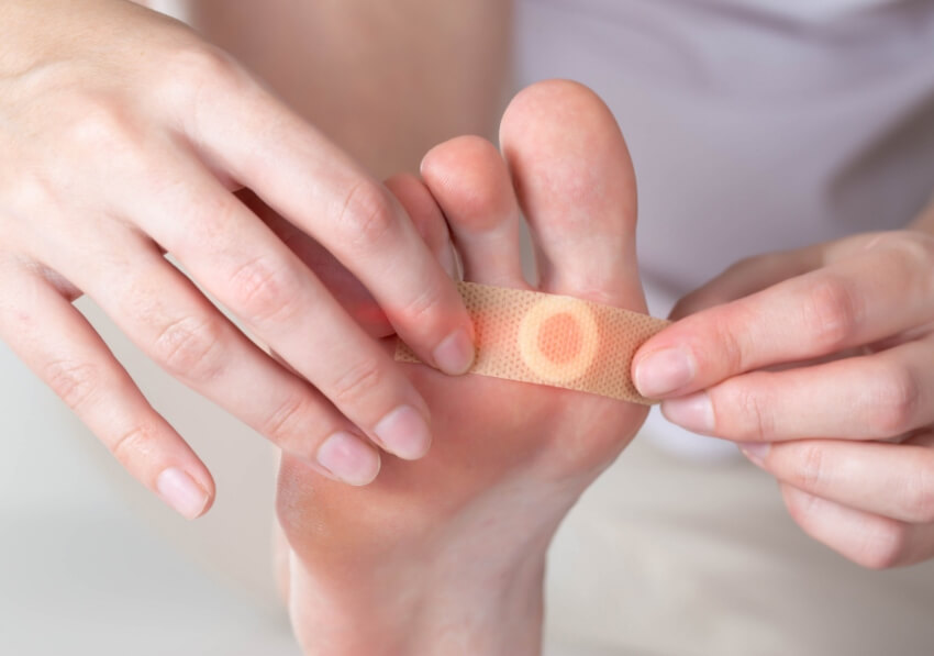 Woman Applying a Plantar Warts Bandage -Treatment in Millsboro and Seaford, DE