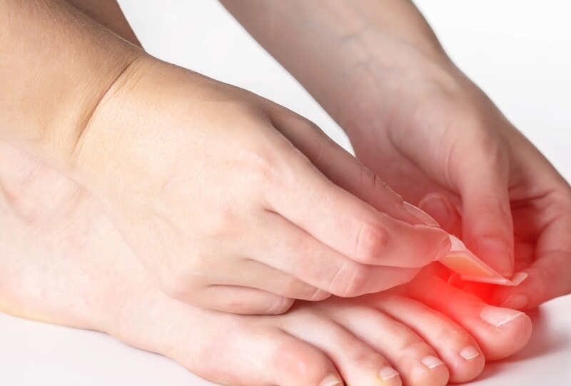 Woman applying bandaid on feet to prevent Plantar Warts 