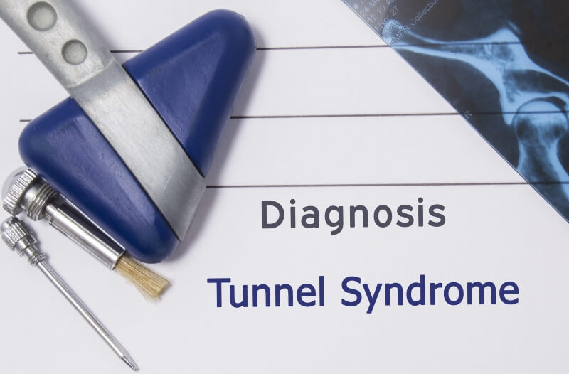 Diagnosis of Tarsal Tunnel Syndrome in Delaware