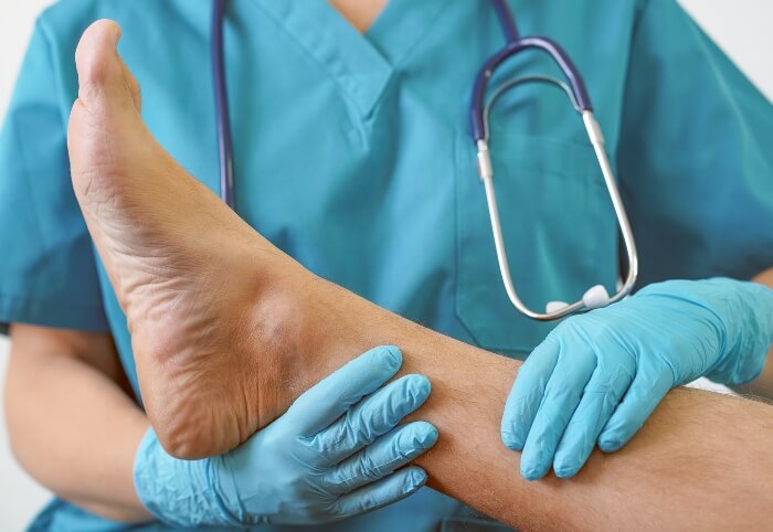 Doctor Checking Foot for Geratic Infection, Southern Delaware Foot & Ankle