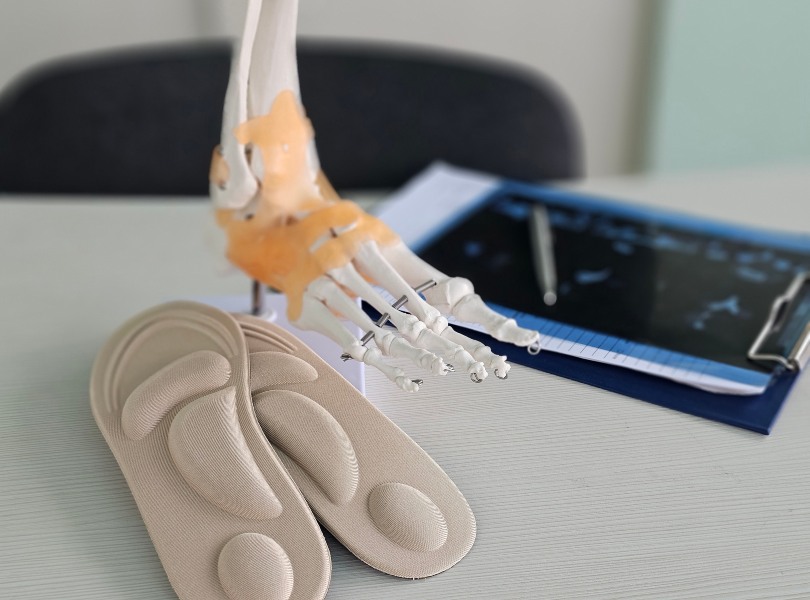 Clinical Display of Foot Structure for Nanoplasty Bunion Surgery in Seaford & Millsboro, DE